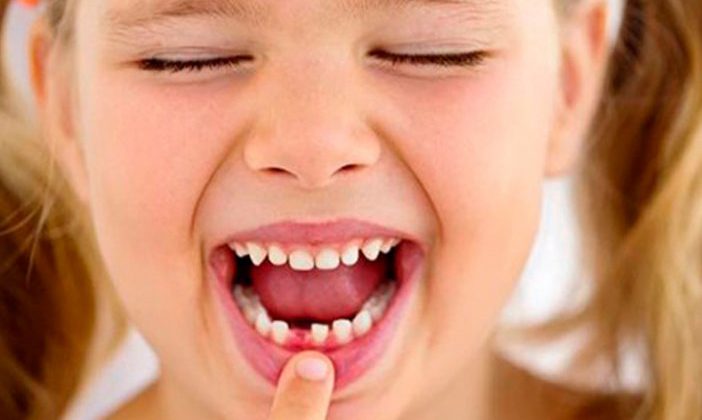 Cuidados a ter com os Dentes de Leite