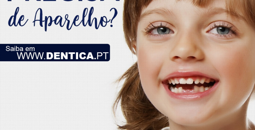 5 indícios de que seu filho precisa usar aparelho ortodôntico