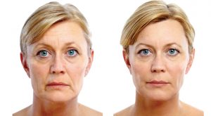 Procedimento de Envelhecimento – Facial Procedimento de Envelhecimento – Facial