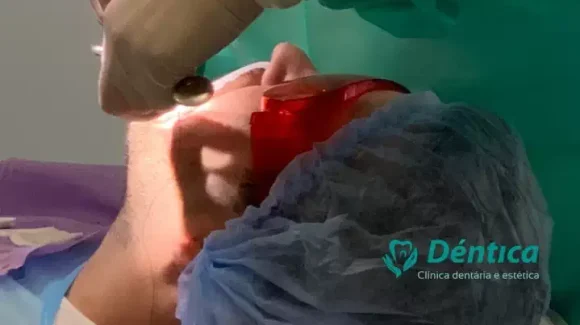 Атравматичное удаление зуба