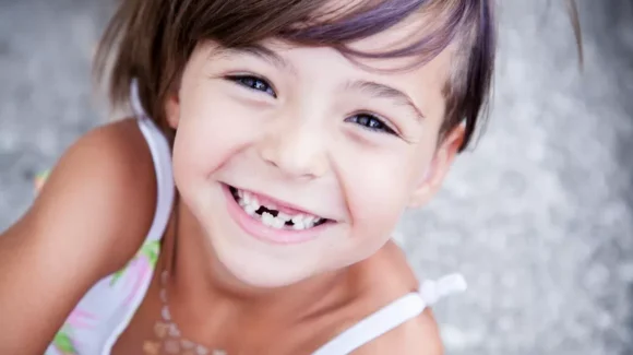 Como ultrapassar o medo do dentista nas crianças?