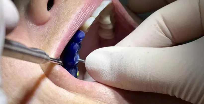 Испытание конструкции основания и коронки моста.