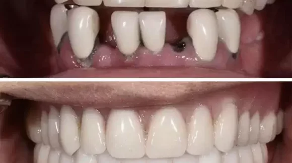 Сделайте шаг к улыбке мечты! / Sorria com confiança!