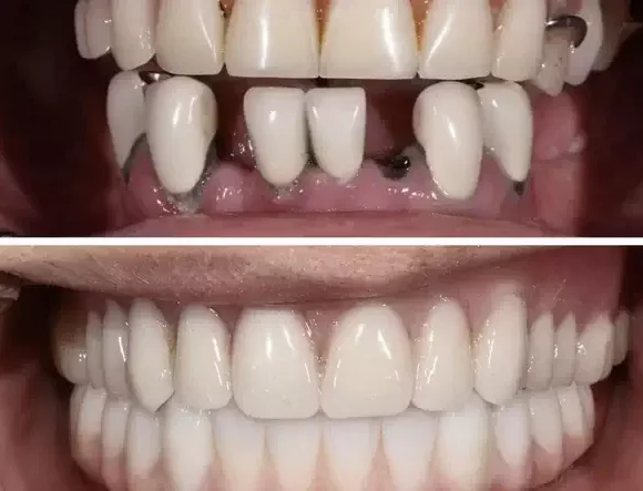 Сделайте шаг к улыбке мечты! / Sorria com confiança!