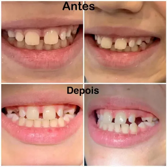 O tratamento ortodôntico