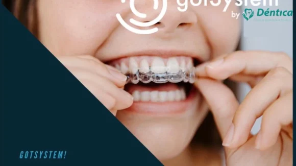 Alinhadores Invisíveis