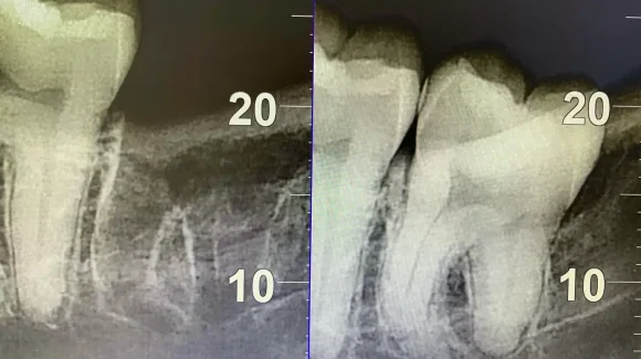 Ровная улыбка