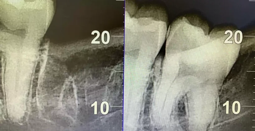 Ровная улыбка