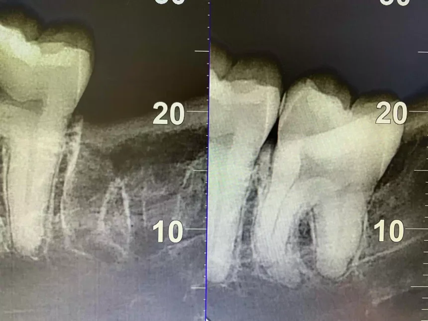 Ровная улыбка