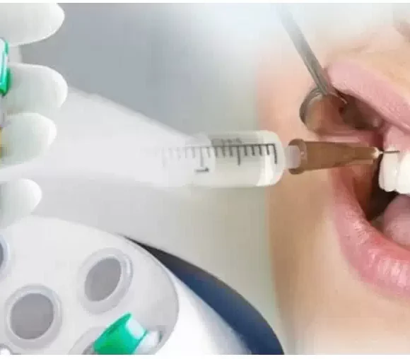 PRP-плазма в стоматологии