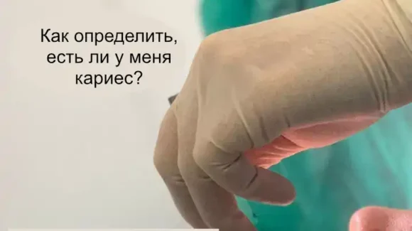 Как определить, есть ли у меня кариес?