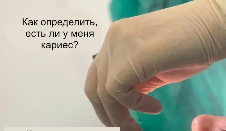 Как определить, есть ли у меня кариес?