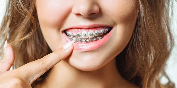 O tratamento ortodôntico